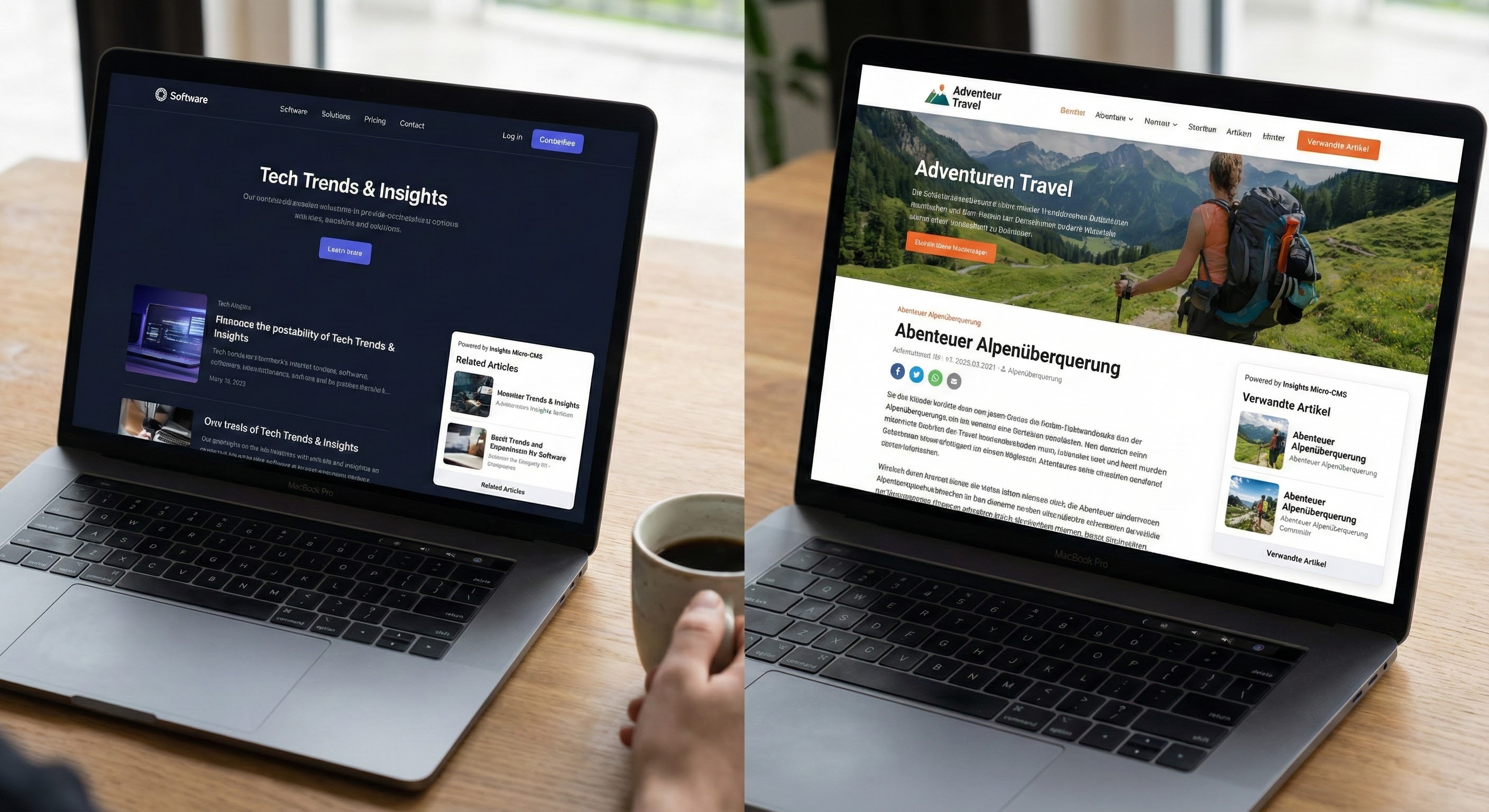 Insights Article CMS